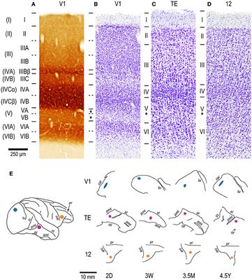 Postnatal Dendritic Growth and Spinogenesis of Layer-V Pyramidal Cells Differ between Visual, Inferotemporal, and Prefrontal Cortex of the Macaque Monkey